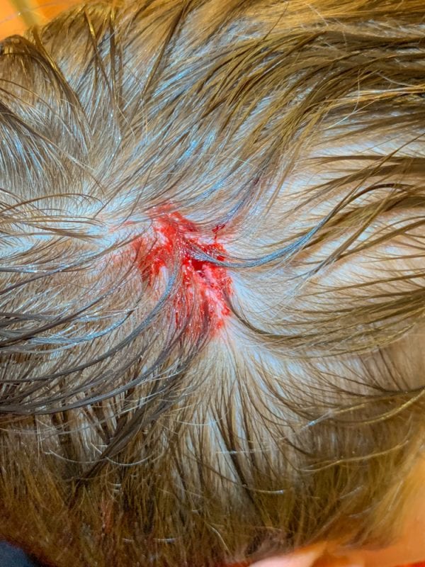 Hair Stitches IMG_4786 s